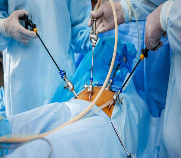 Best Hospital For Laparoscopic Surgery in Silchar