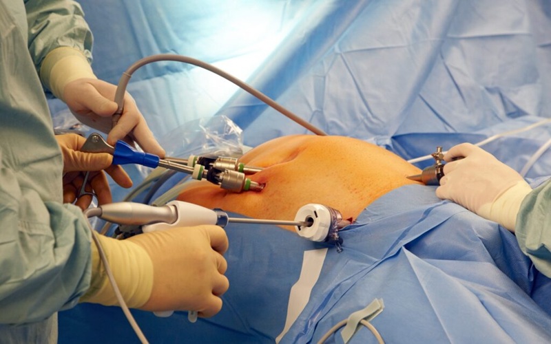 Best Hospital For Laparoscopic Surgery in Silchar